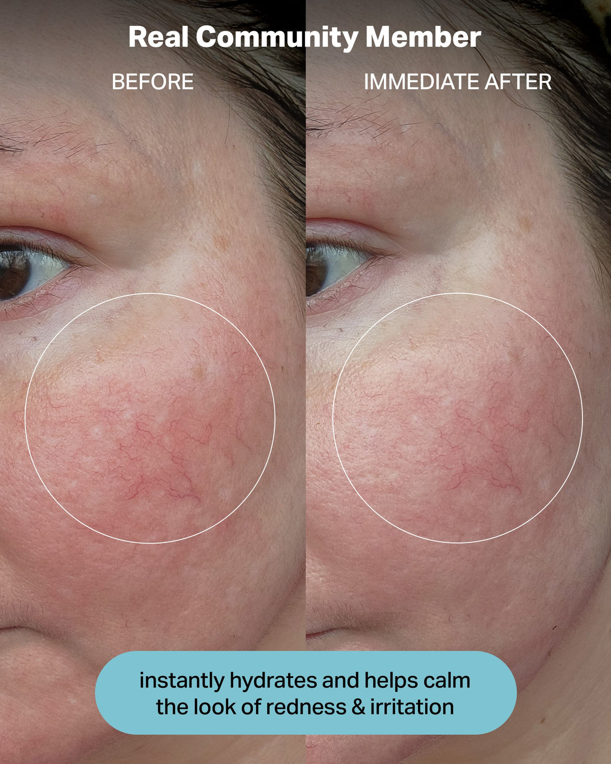 Hydrating Electrolyte Rescue Serum product image 7