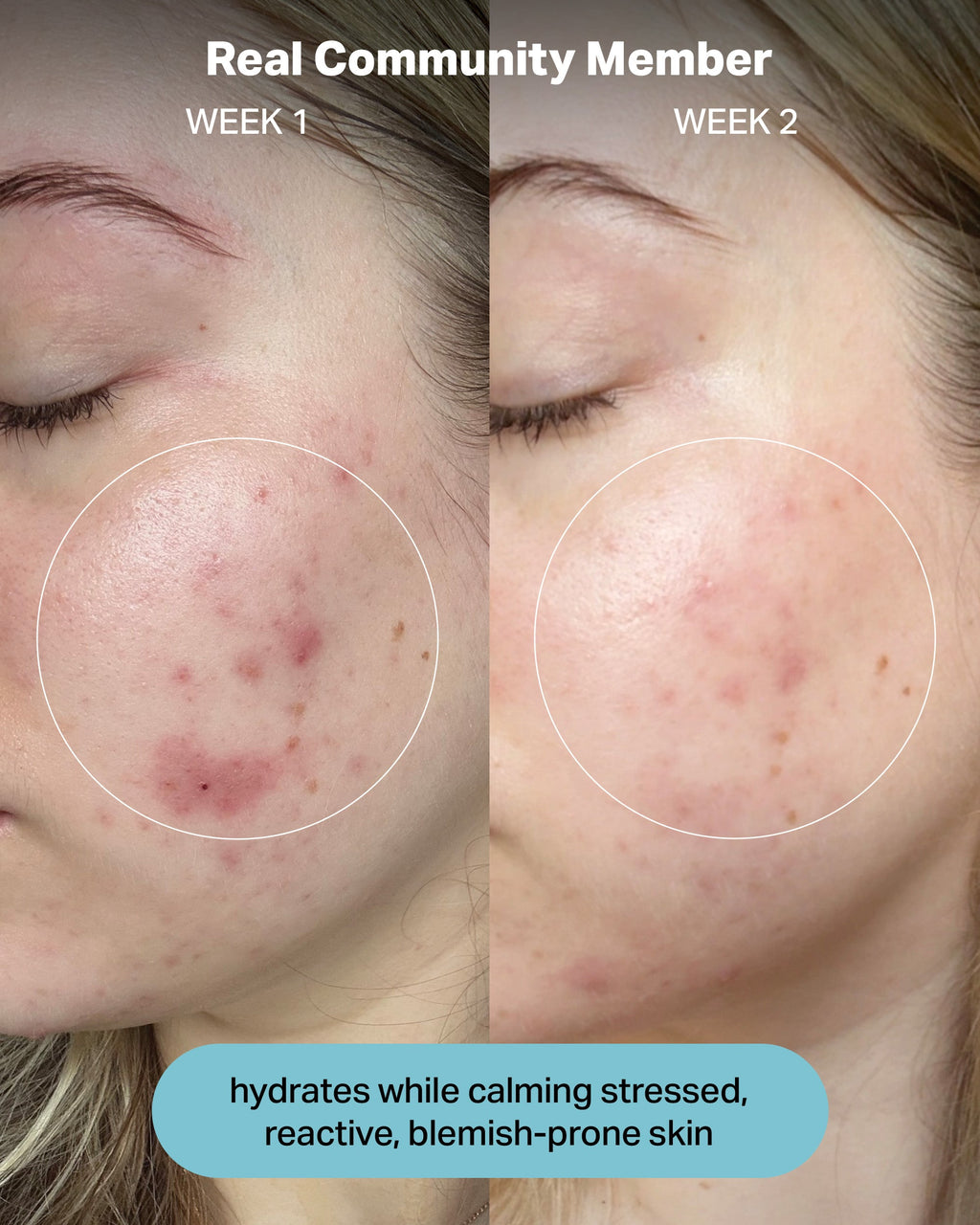 Hydrating Electrolyte Rescue Serum product image 9