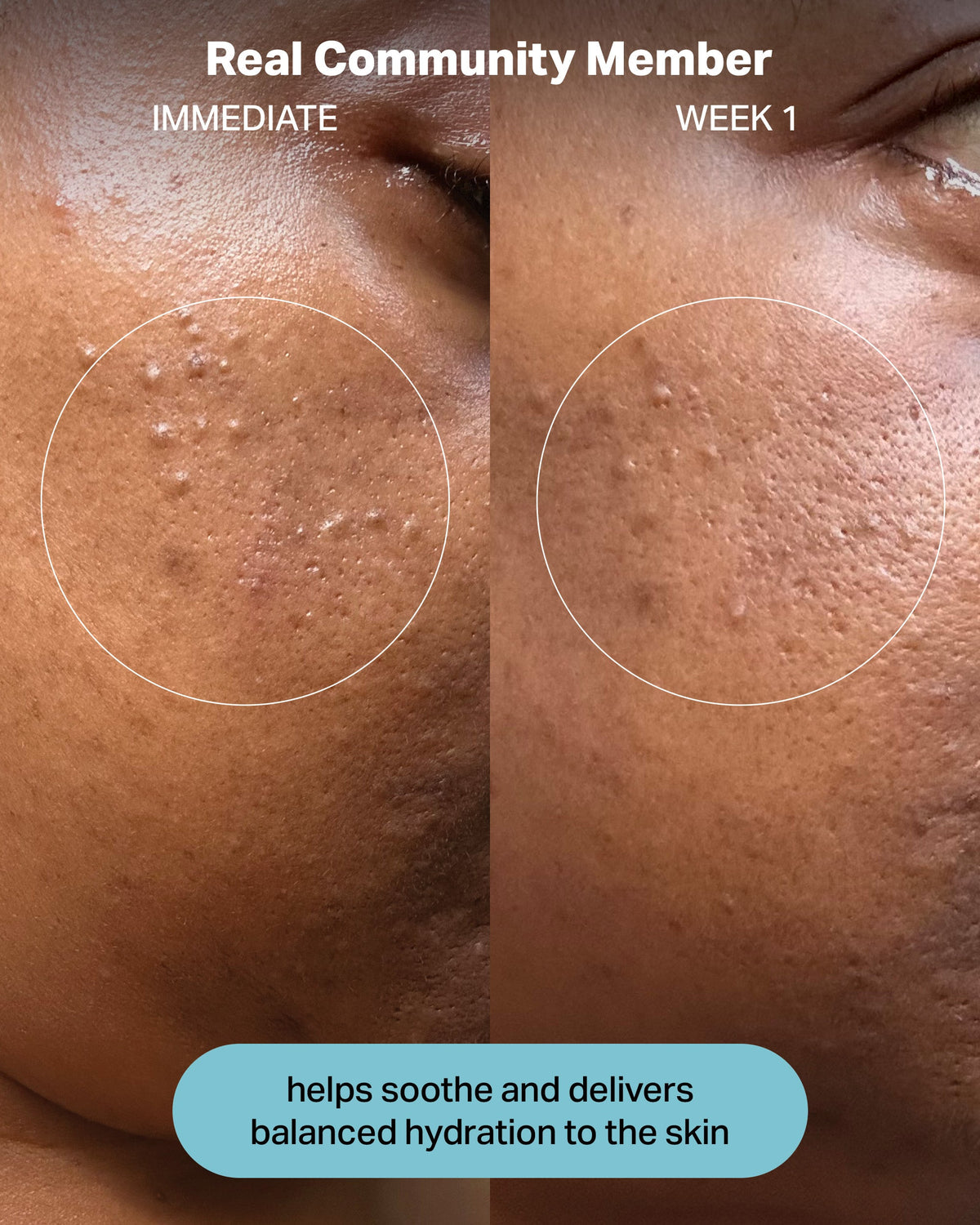 Hydrating Electrolyte Rescue Serum product image 8
