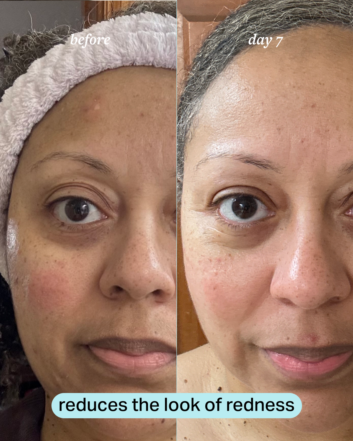 calming magnesium mist product image 5