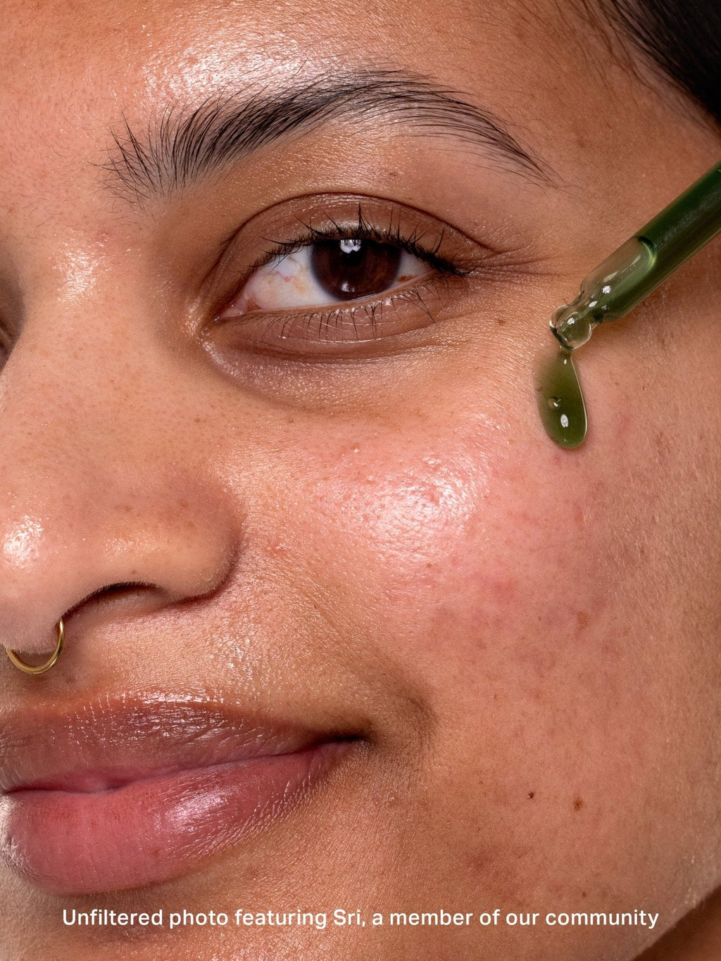 chlorophyll discoloration serum product image 7