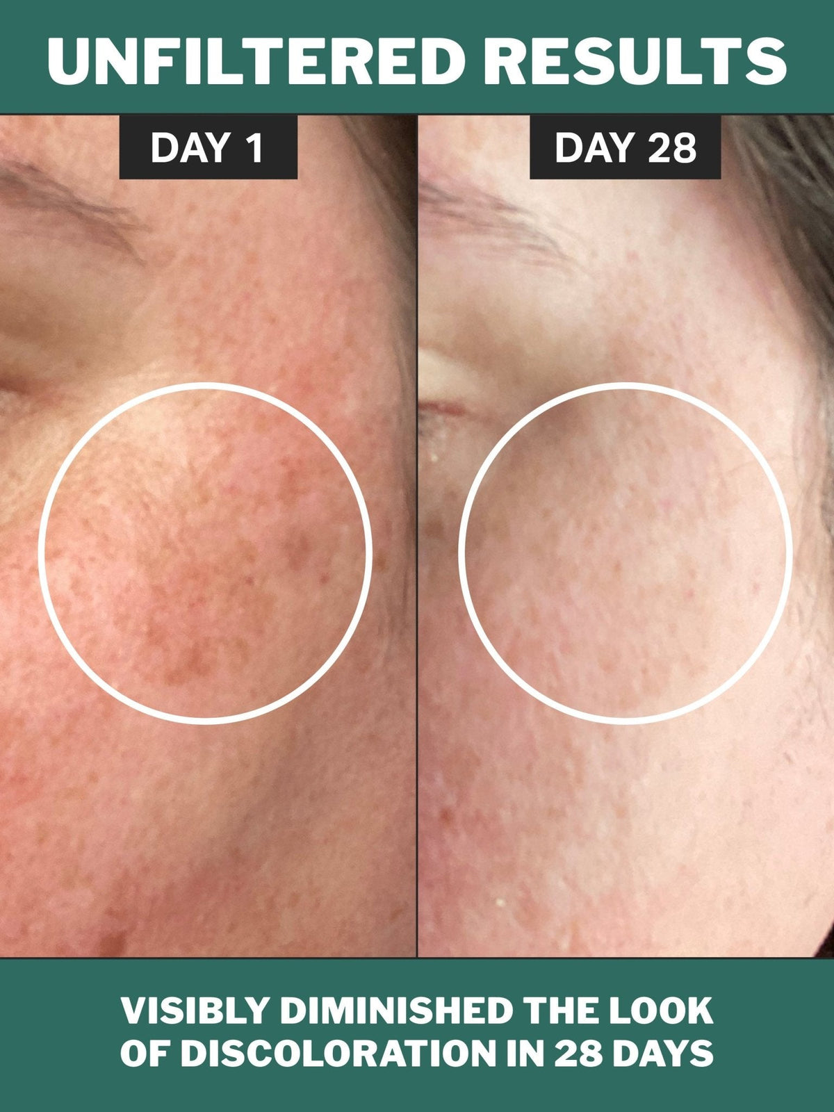 chlorophyll discoloration serum product image 3