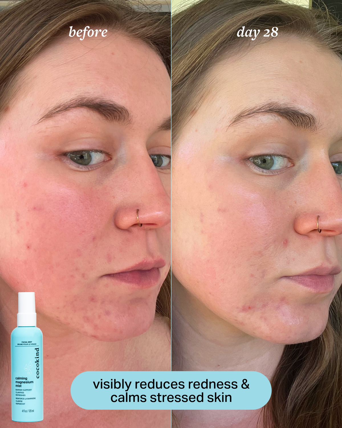 calm & clarify duo product image 5